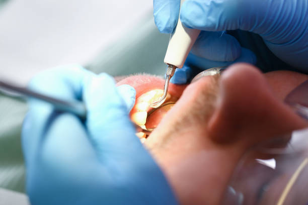 Best Emergency Dentist for Special Needs Patients in East Speer, NC
