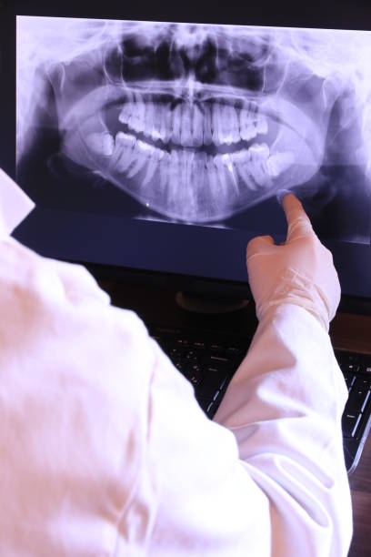 Best Broken or Cracked Tooth Emergency Dentist in East Speer, NC