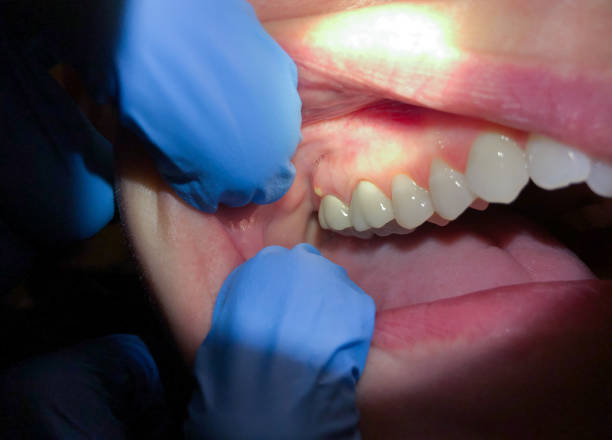 Best Emergency Cosmetic Dentistry in East Speer, NC