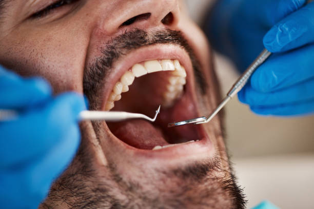 Best Emergency Dentist for Knocked-Out Tooth in East Speer, NC