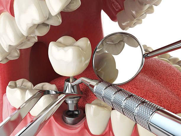 Best Broken or Cracked Tooth Emergency Dentist in East Speer, NC